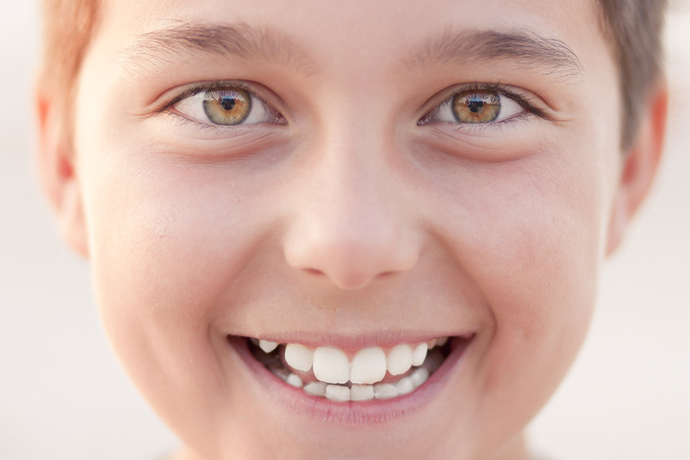 fillings-smile-boy (1)